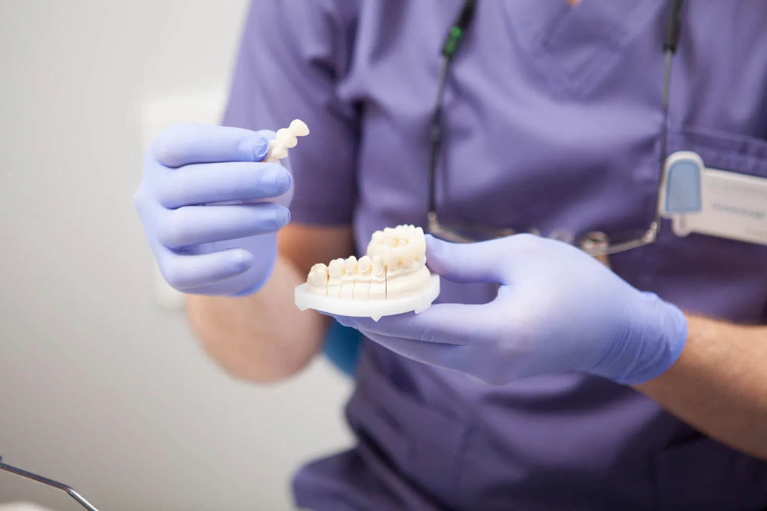 Dental Bridges